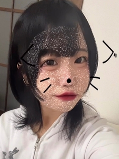 らん